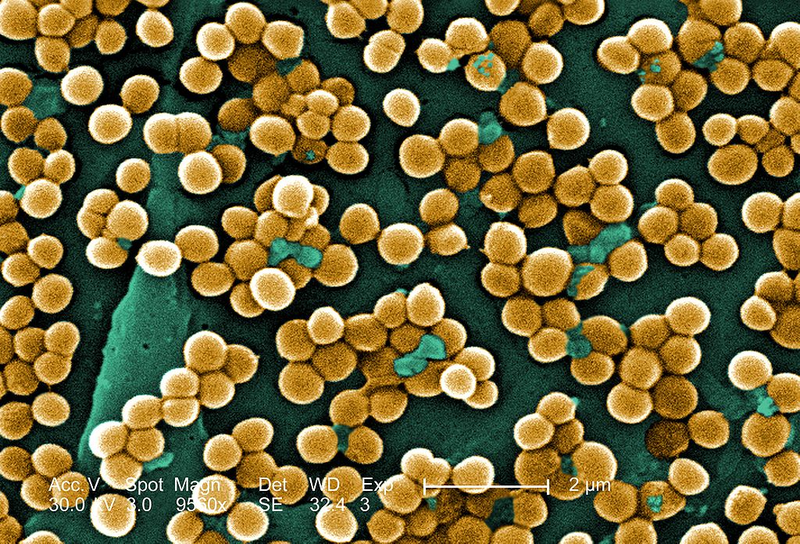 Muestra de Staphylococcus aureus. Foto: Wikipedia.
